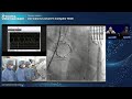 [AP VALVES & SH 2023] Live Case & Lecture 5: Complex TAVR