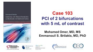 Case 103: PCI Manual - DK crush with 5 mL of contrast