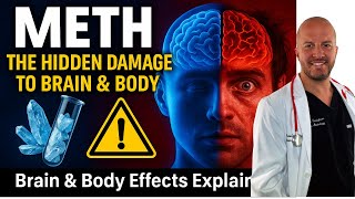 Methamphetamine Abuse: Brain Damage, ‘Meth Mouth’, and More