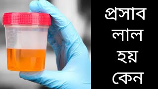 প্রস্রাব বা মুত্র লাল হবার কারন Urine infections symptoms