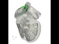 electrical activation sequence in a whole heart