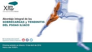 SOBRECARGAS Y TENDINITIS  DEL PSOAS ILÍACO