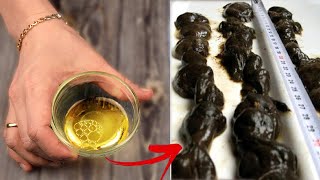 The best home remedy for Removing Fecal stones