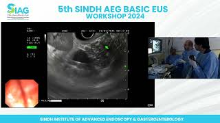 5th Sindh AEG Basic EUS Workshop 2024 (Part 24)