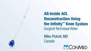 Dr. Mike Pickell - All-Inside ACL Reconstruction Using the Infinity™ Knee System - CONMED Technique