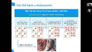 Thalassemia