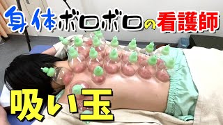 【吸い玉カッピング】首肩背中腰が酷い！スライドカッピングでこりをほぐす【鍼灸院・整体】渋谷区恵比寿コスモ治療院