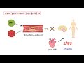 고혈압의 원인 도대체 고혈압은 왜 생기는 걸까요 원인을 바로 알아야 해결할 수 있습니다