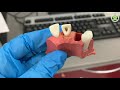 preclinical laboratory demonstration obturation lateral compaction