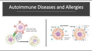 Autoimmune Diseases and Allergies