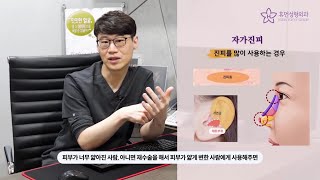 [휴먼성형외과] 코성형 알아보기 3편: 무보형물 코성형 (비중격 연골, 자가진피)