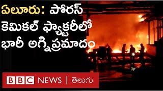 Eluru - Porus Fire Accident: చికిత్స పొందుతున్న వారిలో కొందరి పరిస్థితి విషమంగా ఉంది | BBC Telugu