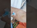 cannulation.. long video.. part 75 #cannula