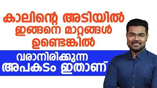 കാലിന്റെ അടിയിൽ ഇങ്ങനെ മാറ്റങ്ങൾ ഉണ്ടെങ്കിൽ വരാനിരിക്കുന്നത് വലിയ അപകടമാണ്...!