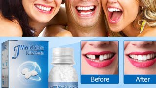 Tooth Repair Granules Temporary Broken Tooth Repair Kit Review 2022   Does It Work