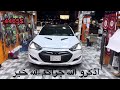 سلسلة تجديد الوحش الكوري جنسيس كوبية 2 بدينا نضبط الخارجيه🧰🚗 genesiscoupe