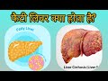 Complete information on Fatty Liver I फैटी लिवर क्या होता है? @DrAshishSachan