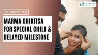 Marma chikitsa for special child \u0026 Delayed milestone