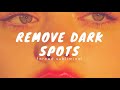 Ｒｅｍｏｖｅ  Ｄａｒｋ  Ｓｐｏｔｓ ｜Ｆｏｒｃｅｄ  Ｓｕｂｌｉｍｉｎａｌ （ｉｍｐｒｏｖｅｄ）