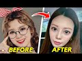 K-Pop Idols Who Did Too Much Plastic Surgery