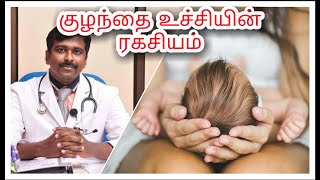 Baby's soft spot (Fontanel) mystery | Tamil | Dr Sudhakar |