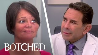 5 Most Supportive "Botched" Families | E!