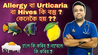 Allergy বা Urticaria বা Hives কি বস্তু, কেনেকৈ হয়, হ’লে কি কৰিব, নহবলে কি কৰিব ?