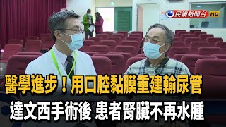 達文西手術 口腔黏膜也能重建輸尿管－民視台語新聞