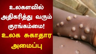 உலகளவில் அதிகரித்து வரும் குரங்கம்மை பாதிப்பு! Monkey Pox