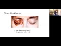 Dr. Muchai Gachago - Retina  Intravitreal Injection Safety; Anti VEGF agents and Techniques