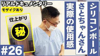 【シリコンボール】ペニスに真珠を注入した感想を赤裸々告白！【1ヶ月検診】