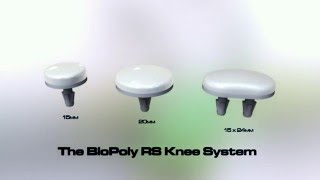 BioPoly RS Knee Surgical Technique Animation