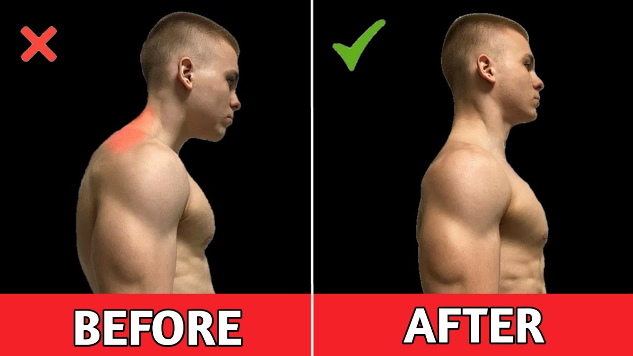 How To Correct Your Posture 10 Home Exercises To Fix Your Posture