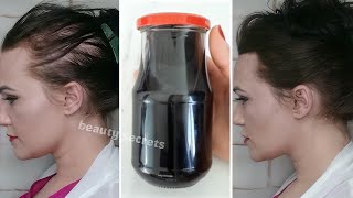 Spray it on your hair for 2 days only and your hair will grow in abundance without stopping