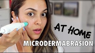 Microdermabrasion at Home | Silk'n ReVit First Impression - TrinaDuhra