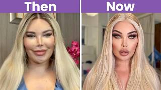20+ Celebrities Before & After Plastic Surgery (Shocking Transformations)
