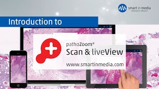 PathoZoom® Scan & PathoZoom®LiveView