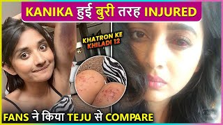 Kanika Mann Brutally Injured, Fans Compare Her To Tejasswi Prakash | KKK12