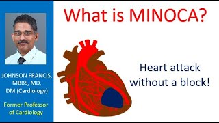 What is MINOCA?