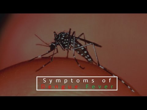 Dengue | Symptoms of Dengue | Symptoms of Dengue Fever Dengue | Symptoms of Dengue | Symptoms of Dengue Fever