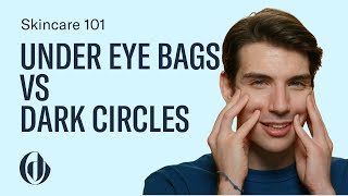 Difference Between Under Eye Bags and Dark Circles (and How to Treat Them!)