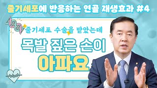 무릎 연골 재생을 위해 주의해야 할 점들 [줄기세포에 반응하는 연골 재생효과#4]