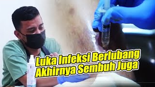 Luka Undermining/berlubang kini sudah SEMBUH !!!!