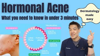 Hormonal acne explained in under 3 minutes | Dermatologist reviews