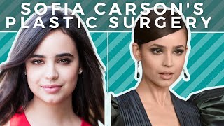 Disney Plastic Surgery Sofia Carson S Facial Transformation