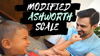 MODIFIED ASHWORTH SCALE: Review the MAS and original Ashworth Scale with me.