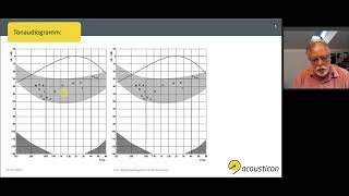 Ton- Sprachaudiogramm interpretieren