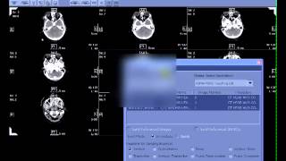 MIRC Tutorial: Getting Images Into MIRC, Part I
