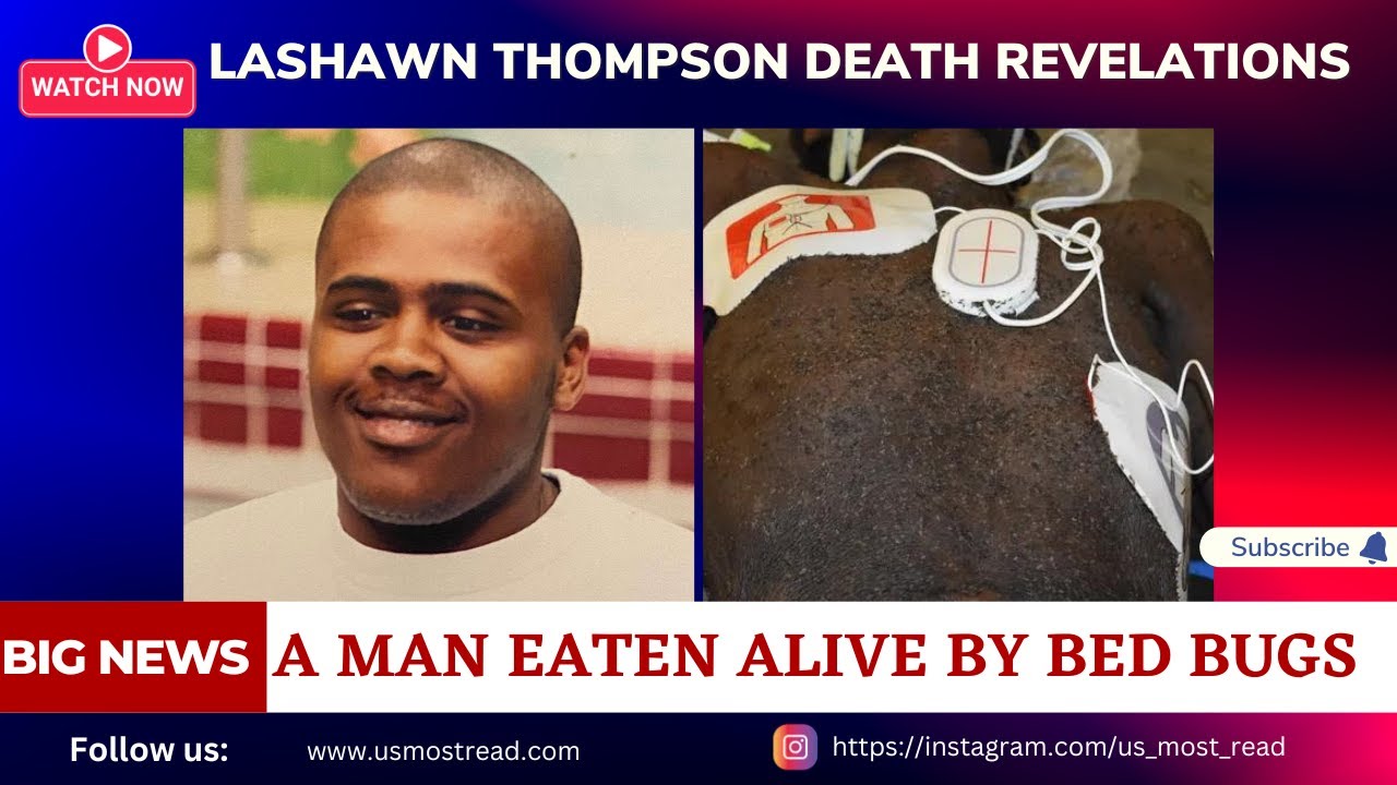 LaShawn Thompson Eaten Alive By Bed Bugs | Fulton County Jail | LaShawn ...