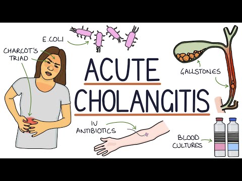 What antibiotics are used to treat cholangitis?